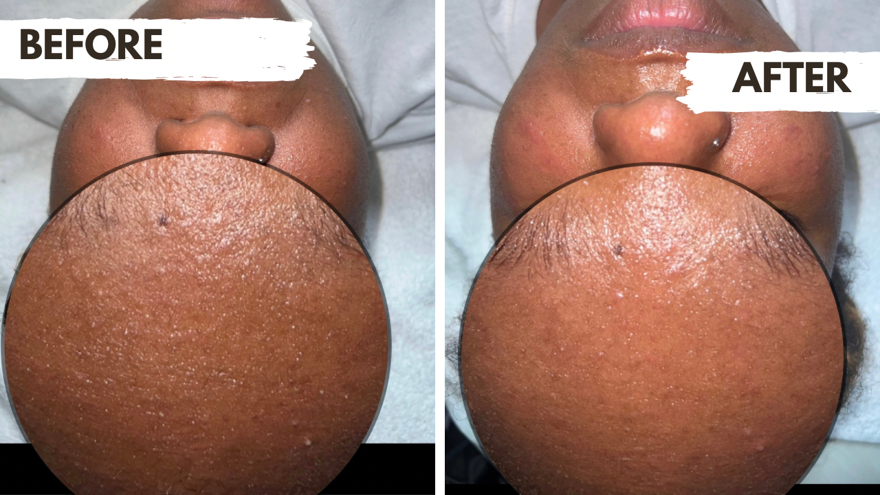 Subscription Essential Glow Maintenance Facial