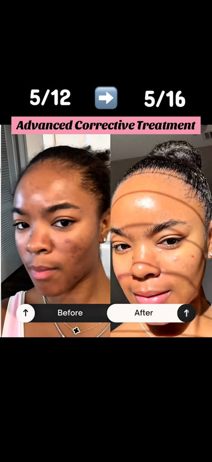 Student advanced corrective facial client progress, before and after