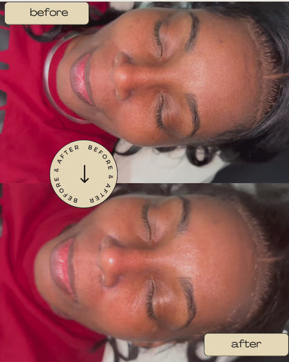Honey Glow Deep Cleaning Facial