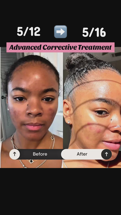 🧬 Advanced Corrective Skin Treatment