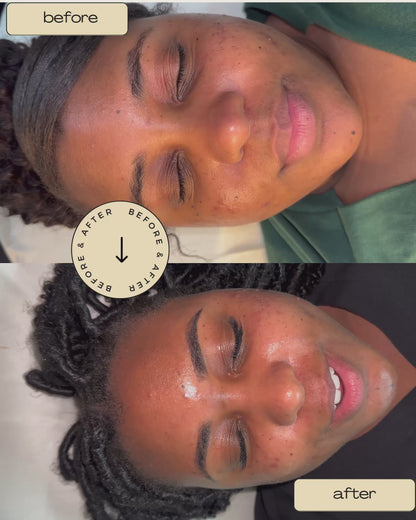 Student Deep Cleaning Facial