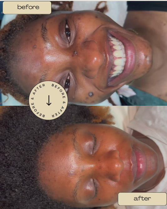 🧬 Advanced Corrective Skin Treatment