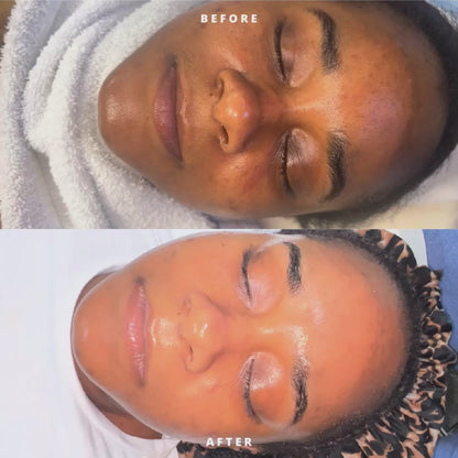 Membership Appointment Honey Glow Deep Cleaning Facial