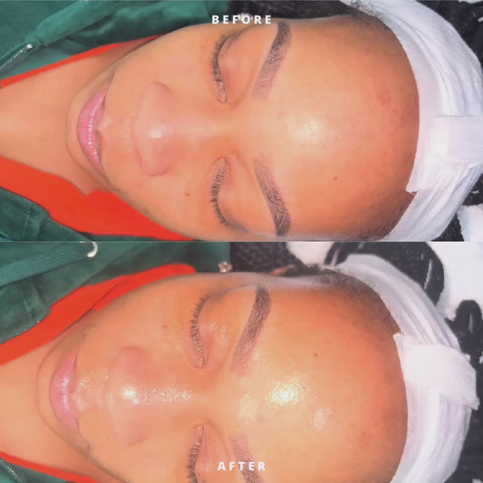 Essential Glow Maintenance Facial