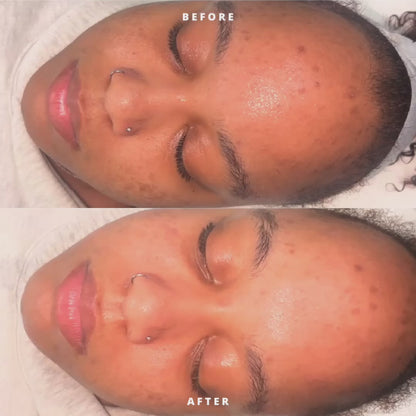 Honey Glow Deep Cleaning Facial
