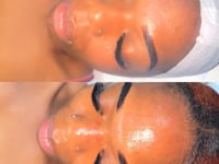 Subscription Honey Glow Deep Cleaning Facial