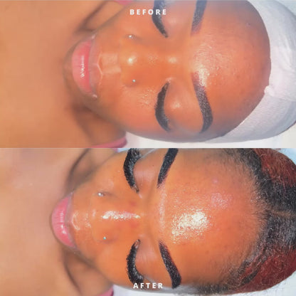 Honey Glow Deep Cleaning Facial