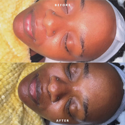 Membership Appointment Honey Glow Deep Cleaning Facial