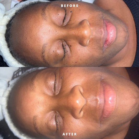 Student Glow Facial