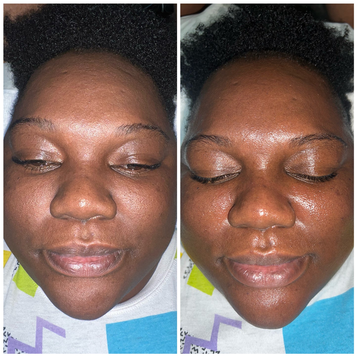 Subscription Appointment Honey Glow HydroFacial