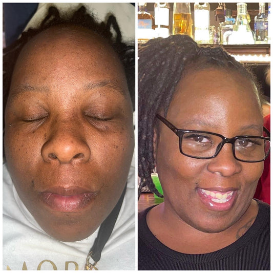 Subscription Appointment Honey Glow HydroFacial